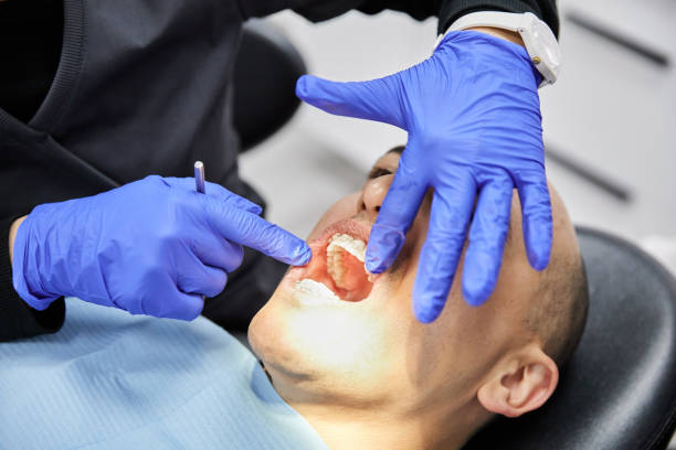 Best Dental Abscess Treatment in Huntsville, TX